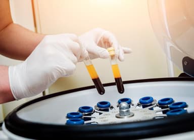 Platelet Rich Plasma (PRP)