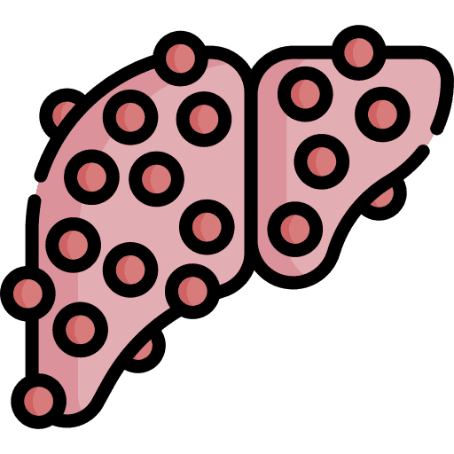 Liver Cirrhosis