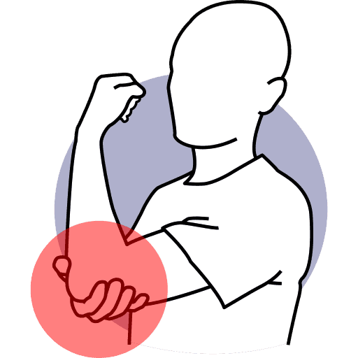 Elbow Pain