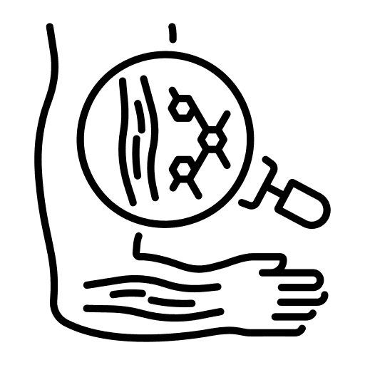 Muscular Dystrophy