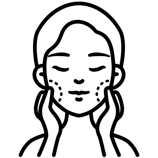 Melasma