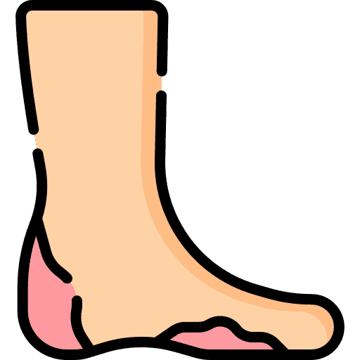 Diabetic Foot Ulcer